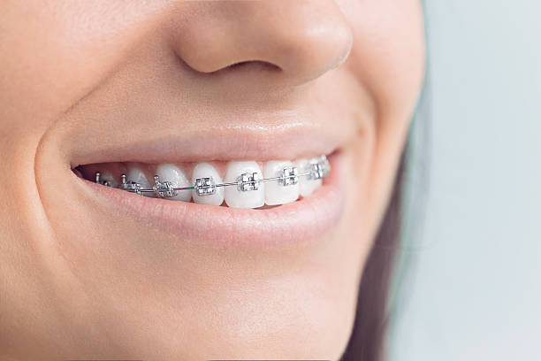 Best Full Mouth Reconstruction  in Union Gap, WA